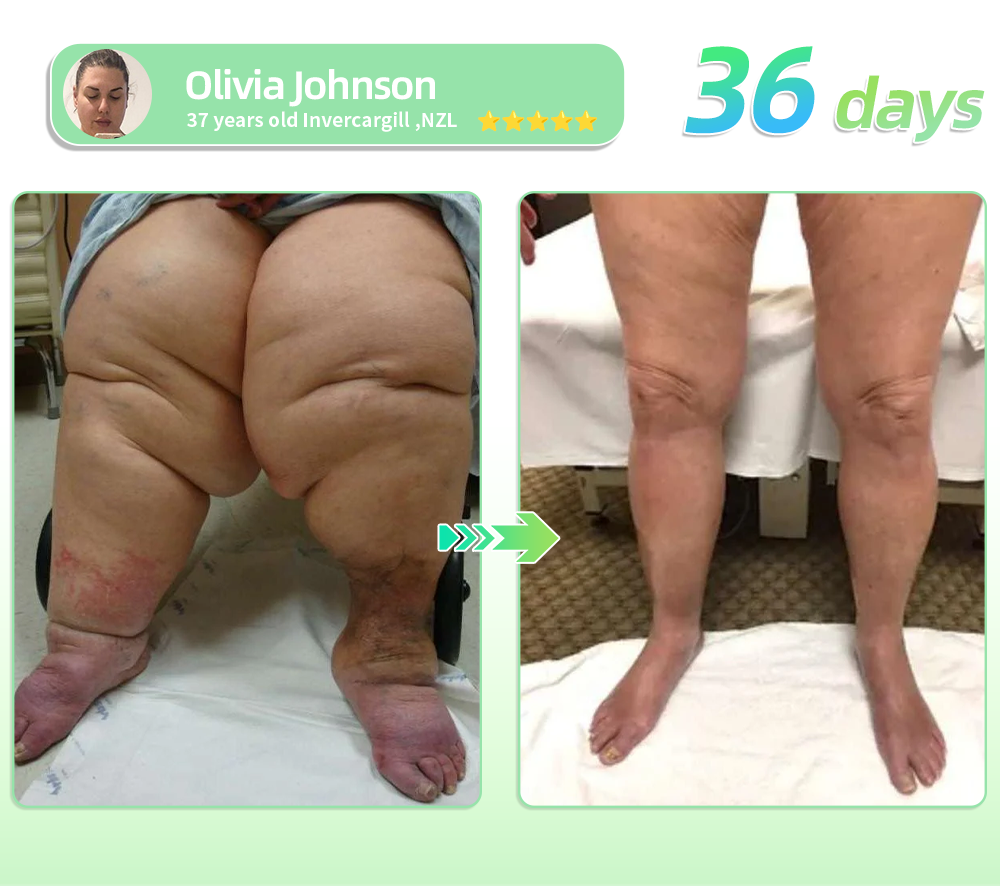 🔥 Only 10 boxes left! We're giving you an extra 30% OFF! HHVB® GLP-1 Micro Slimming Beads are doctor-tested and proven effective — just 7 to 8 boxes are enough to help manage your weight and blood sugar levels with long-lasting results.