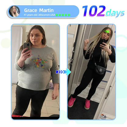 【𝙇𝙖𝙨𝙩 𝘿𝙖𝙮 𝙋𝙧𝙤𝙢𝙤𝙩𝙞𝙤𝙣 70% 𝙊𝙁𝙁💥🔥】𝐇𝑯𝑽𝐁® 𝙉𝙄𝘿𝘿𝙆-𝙏𝙞𝙧𝙯𝙚𝙥𝙖𝙩𝙞𝙙𝙚 𝙉𝙖𝙣𝙤 𝙈𝙞𝙘𝙧𝙤𝙣𝙚𝙚𝙙𝙡𝙚 𝙋𝙖𝙩𝙘𝙝 👨‍⚕️（𝙕𝙚𝙧𝙤 𝙋𝙖𝙞𝙣, 24/7 𝙍𝙚𝙡𝙚𝙖𝙨𝙚 | 𝙇𝙤𝙨𝙚 9 𝑘𝑔 𝙁𝘼𝙎𝙏 | 90% 𝙎𝙪𝙜𝙖𝙧 𝘿𝙧𝙤𝙥 | ）